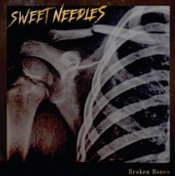 Sweet Needles : Broken Bones